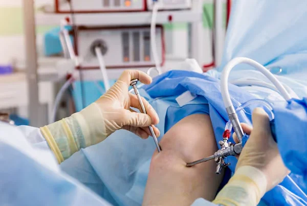 ACL Reconstruction Surgery