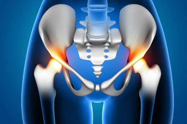 Sacroiliac Joint Pain